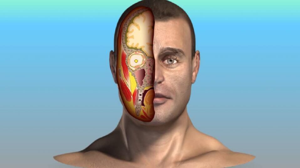 Lengthening Temporalis Myoplasty (MAT